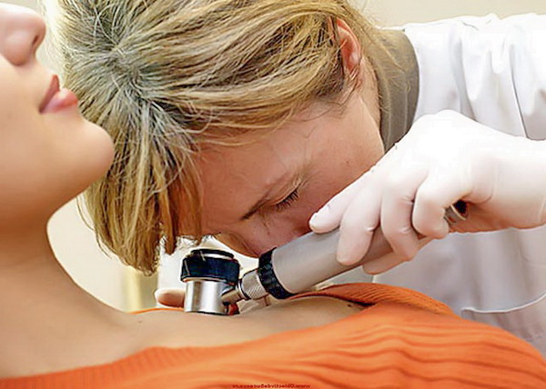 Лечение рака кожи в Германии